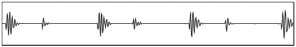 Heart sound waveform recording with repeating beats shown as spikes on a flat line