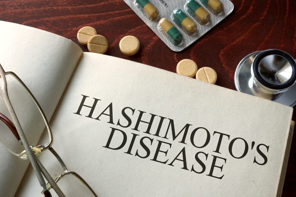 WHAT IS THE BEST DIET TO HELP HASHIMOTO’S DISEASE