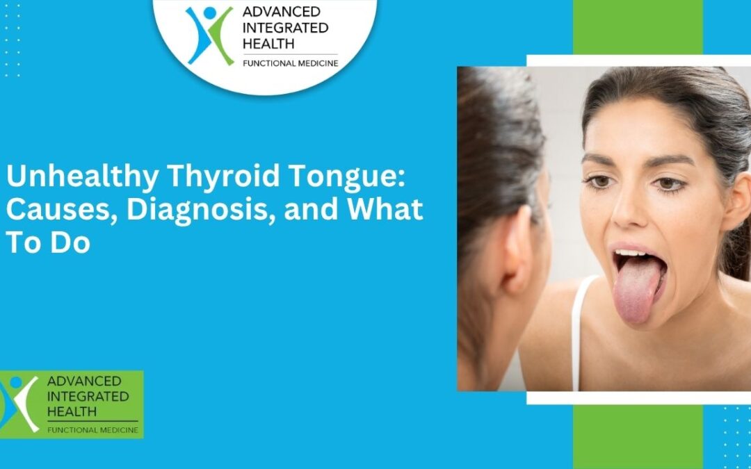 Unhealthy Thyroid Tongue: Causes, Diagnosis, and What To Do