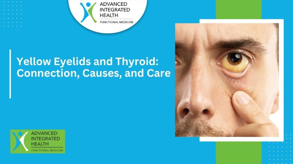 Yellow Eyelids and Thyroid: Connection, Causes, and Care