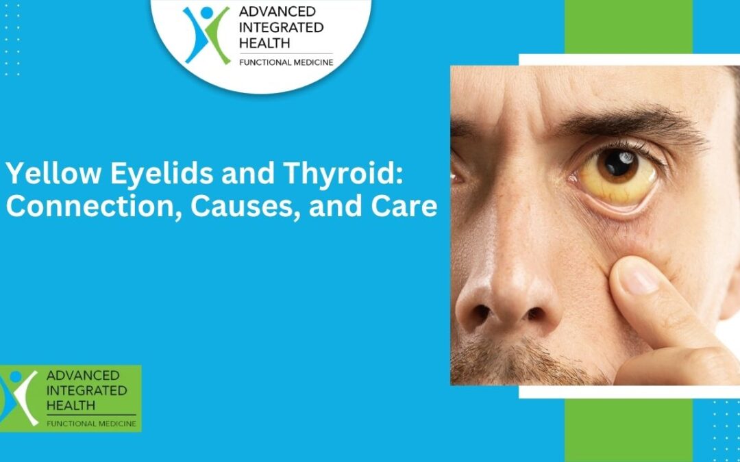 Yellow Eyelids and Thyroid: Connection, Causes, and Care