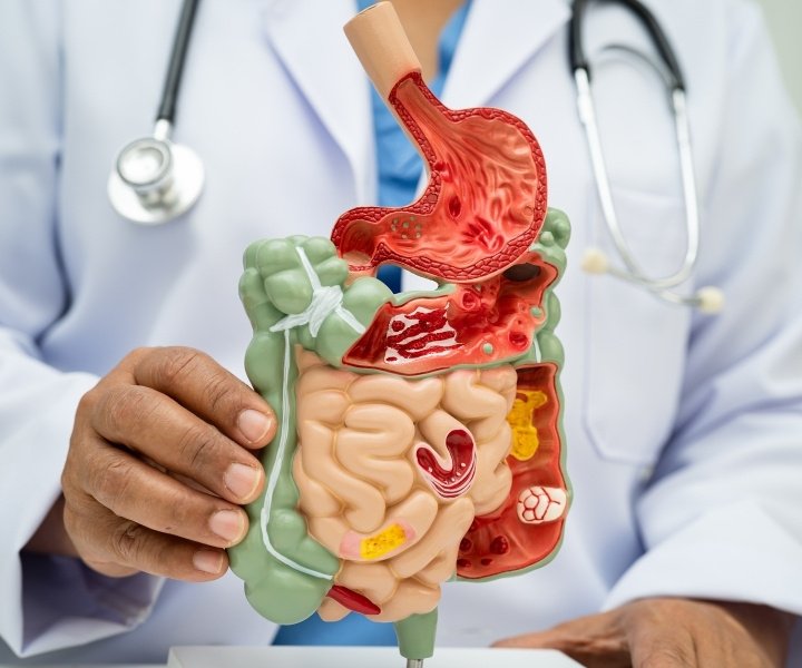 Gut health and ibs treatments